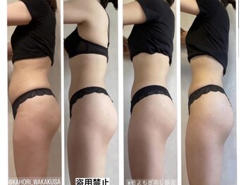 ミミルーチェ(mimiluce)/肌や体の改善若よもぎ蒸しコース