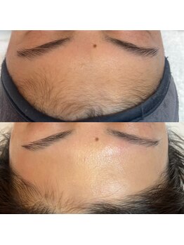 ラティーク 諫早西口店/マリムーブフェイシャルWAX