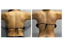 ラヴィエール(Laviere)/【レディース痩身120分】