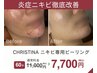 【繰り返す頑固ニキビケアでお悩みの方】3ヶ月改善プログラム☆初回体験¥7700