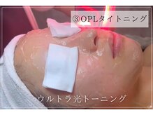 ボータン 恵(Beau Temps)/3.OPLタイトニング/光フォト