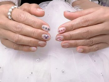 ミキ(MIKI)/定額シンプルコース