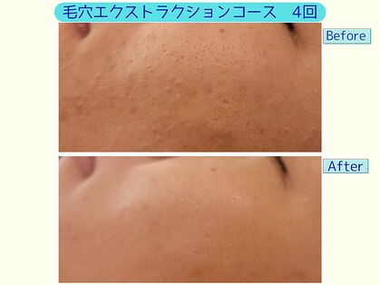 エントテ(en to Te)の写真