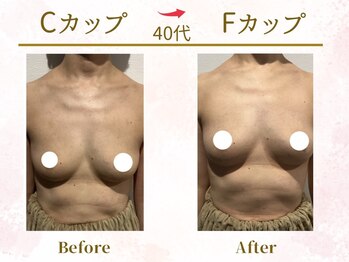 Ms.やまとなでしこ 明石店/ビフォーアフター