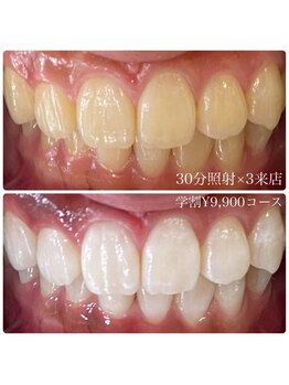 ホワイトニングルーム 川崎店(WhiteningRoom)/ホワイトニング/川崎