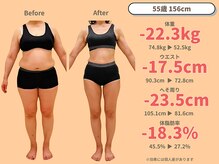 ニドム/55歳　-22kg大幅痩身ダイエット1