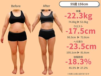 ニドム/55歳　-22kg大幅痩身ダイエット1