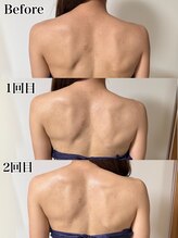 エステ リラクゼーションサロン(more)/背中ハーブピーリング