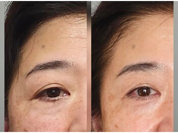 杏月(Kyozuki)/だまされた思って受けてみて!