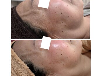 越前屋/2週間後もプリプリ