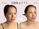 アンジェリカ(Angelica)の写真