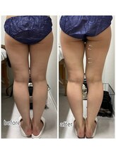 エンチャント(ENCHANT)/内ももの隙間全然違います☆