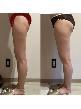 クーラ テュセ(Coeur la Tusais)/