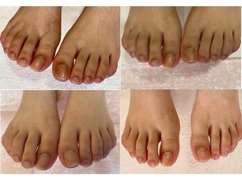 ビサンテ サロン/爪の悩みを解消できる足自爪育成