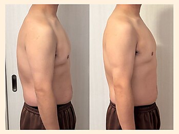 ラフリー 栄伏見院(RUFFREE)/筋膜リリースで肩こり猫背を撃退