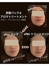 イエルバブエナ/炭酸パックの効果！