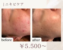 ノースフェイシャルズ(North facials)