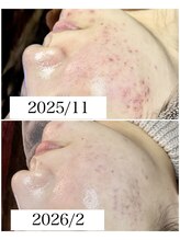 ブラックボックス(BLACK BOX)/20代女性のお客様