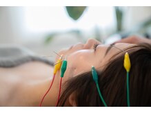 あかり鍼灸接骨院/SNSで話題！人気の美容鍼