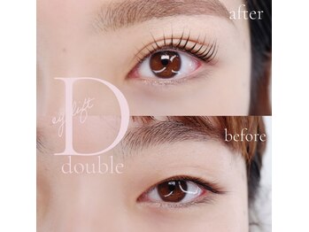 ミヨン(Miyong)/ぱっちりな目になりたい方