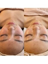 ララルアナ(Lara luana)/潤いフェイシャルケア