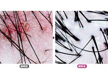 ワヤンプリ 麻布十番店/頭皮スコープ診[港区/麻布］