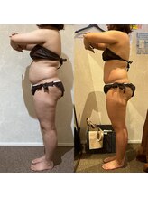 ラナ 甲府本店(Lana)/お客様のビフォーアフター