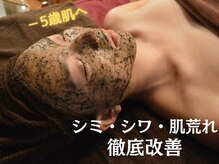 ユウヅツ(Uzutsu)の雰囲気（しみ/しわ/肌荒れ.徹底改善!肌質変化を感じれるハーブピーリング）