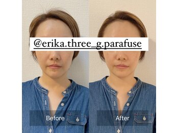 スリージー/before/after