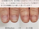 地爪育成コース【3ヵ月(全8回)】