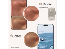 ハリーベージュ(Hariy Beige)/HariyBeige麻布十番