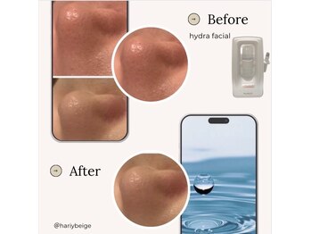 ハリーベージュ(Hariy Beige)/HariyBeige麻布十番