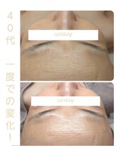 アルム(Areum)/つやつやんのお肌へ♪