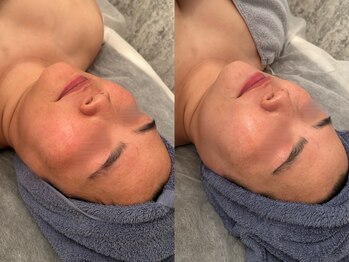 ポーデベロア(Peau des velours)/3月キャンペーン