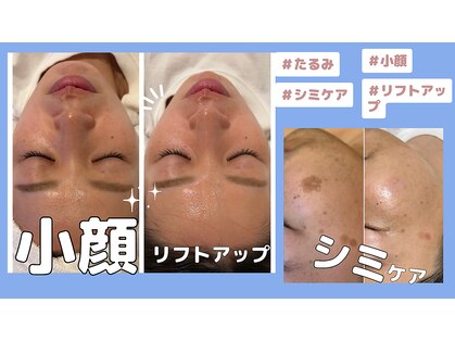 ミライ(Mirai)の写真