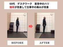 富雄みなみ整骨院/施術後ビフォーアフター