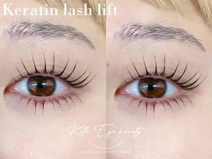 キラアイビューティー 武蔵小杉 新丸子(killa eye beauty)の写真