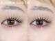 キラアイビューティー 武蔵小杉 新丸子(killa eye beauty)の写真