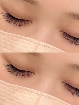 エン(EN)/丁寧なカウンセリングが魅力♪