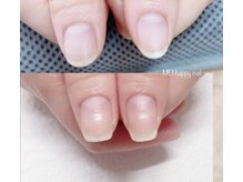 メイハッピー(MEI happy)/自爪育爪育成コース