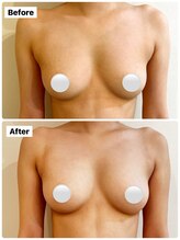 アンシャンテ(ENCHANTER)/光バストアップ