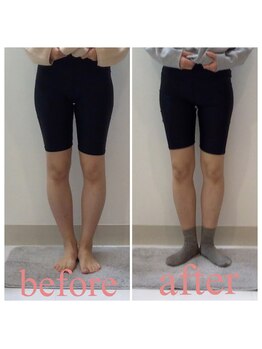 スタイルラボ高松/産後骨盤矯正の効果♪