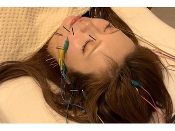 デルタエヌピー63+(δnp63+)/お客様施術例【小顔/薬院/福岡】