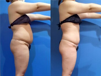 プリオール 高崎店(Prior)/インド痩身