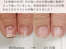 地爪育成コース【3ヵ月(全8回)】