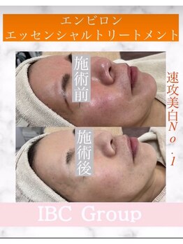 トータルサロンアイビーシー(トータルサロンIBC)/エンビロンでビタミンチャージ!
