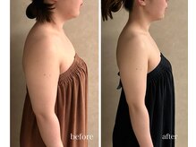 プレジール(Plaisir)/レモンボトル＆高周波＆モナリザ