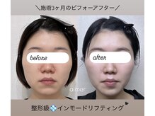 エメ 名古屋栄店(aimer)の雰囲気（小顔ケア＆痩身は当店へ♪詳しくはをブログ&フォトをチェック→）