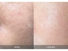 ルメージュ(Lemeju)/ダクトピール