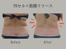 プレリー 自由が丘店/バキューム/筋膜リリース